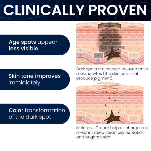Dark Spot Remover Cream for Intimate Areas | Inner Thigh Armpits Elbows Knees Bikini Areas & Lines | w Glycerin Citric Acid Chrysin | Skin Discoloration Cream for Private Parts | Made in Italy - Image 4